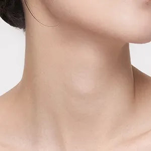 imgi_54_Skin_Concerns_02_large_7eda379c-427a-4dbe-97bf-d9ec65ba9919_webp